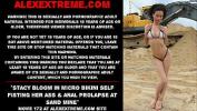 คลิปxxx Stacy Bloom in micro bikini self fisting her ass amp anal prolapse at sand mine